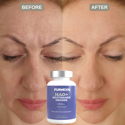 Furnexis® NAD+ Nicotinamide Riboside Plus